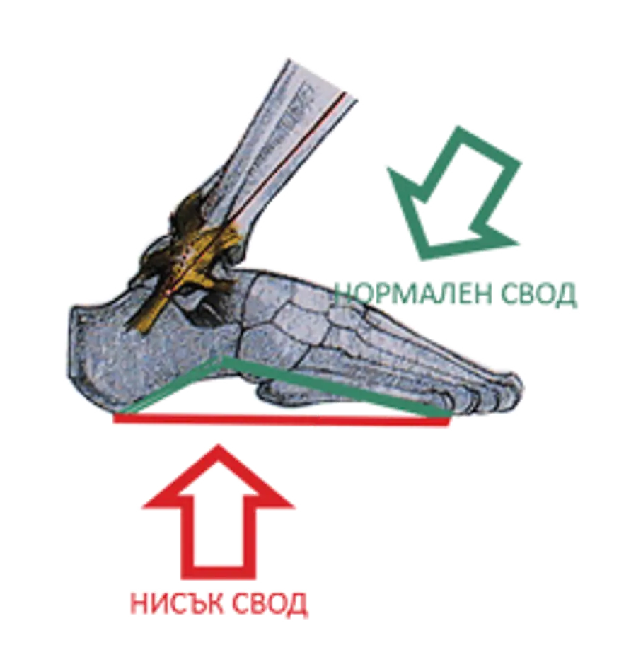 нисък свод